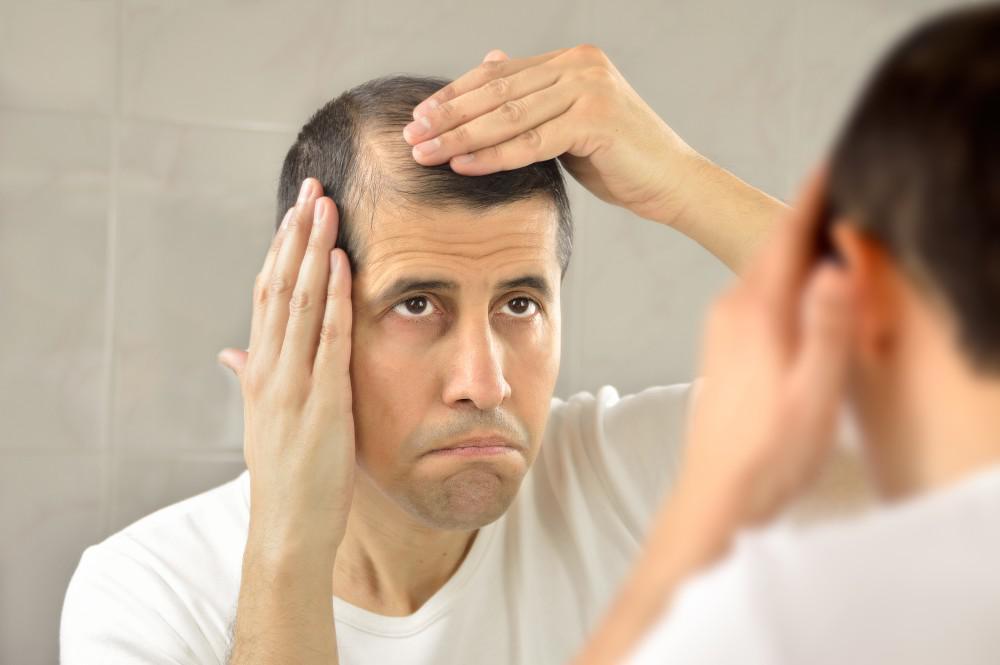 5 Benefits of Hair Restoration